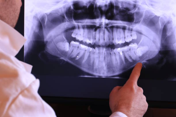 Best Emergency Treatment for Dental Infections or Abscesses in Lockhart, TX