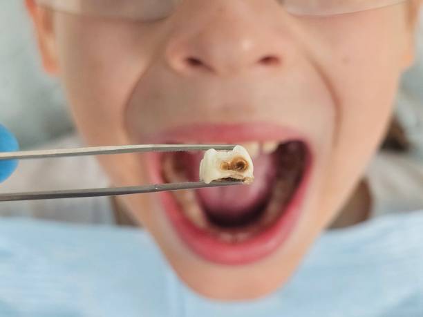 Best Weekend Emergency Dentist in Lockhart, TX