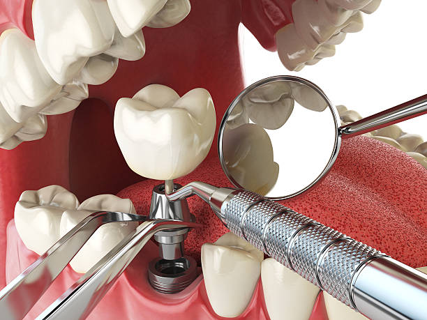 Best Emergency Dental Care for Broken or Chipped Teeth in Lockhart, TX